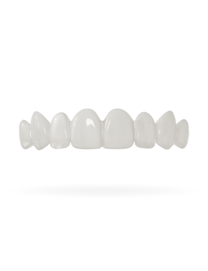 Veneera-Zahn-Veneers-Zahn-VeneerObenNaturweiss