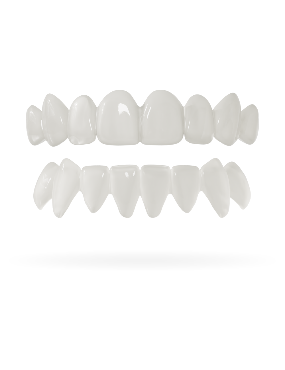 Veneera-Zahn-Veneers-Zahn-VeneerObenUntenNaturweiss