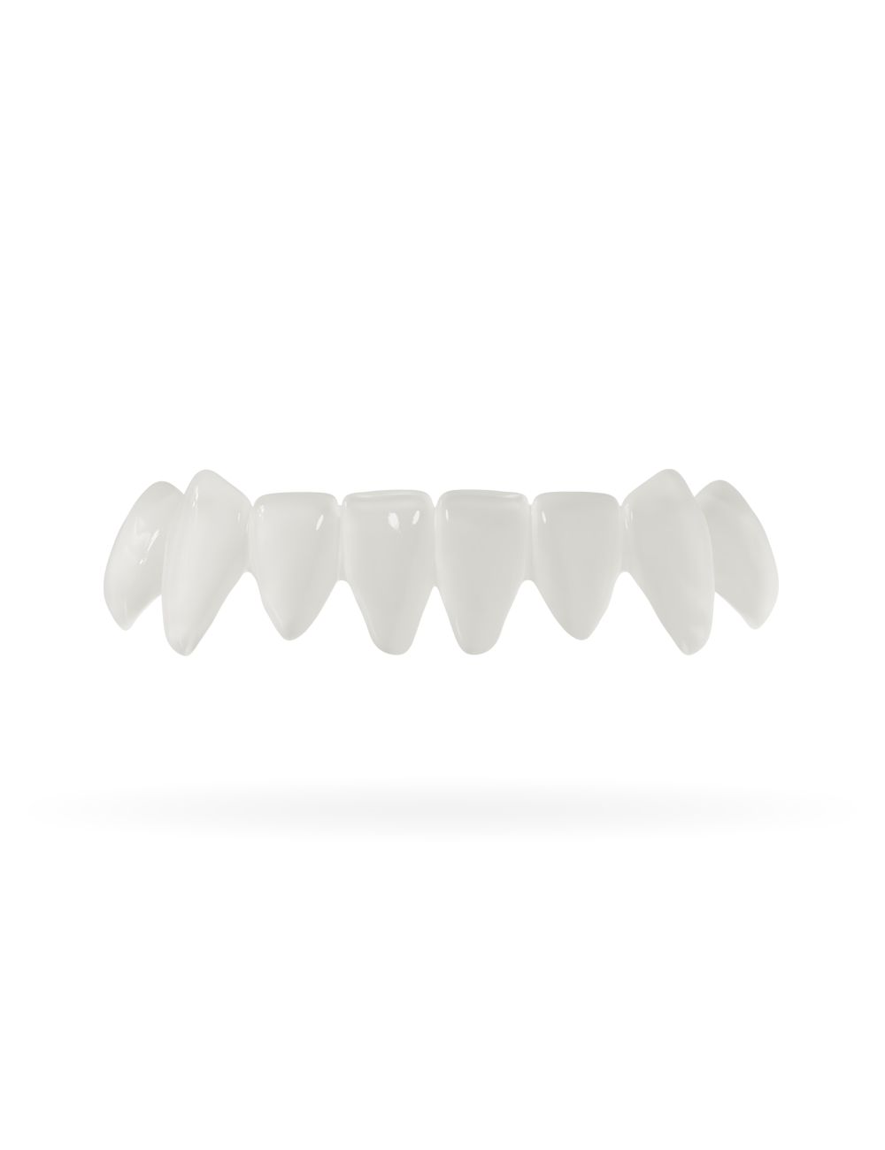 Veneera-Zahn-Veneers-Zahn-VeneerUntenNaturweiss