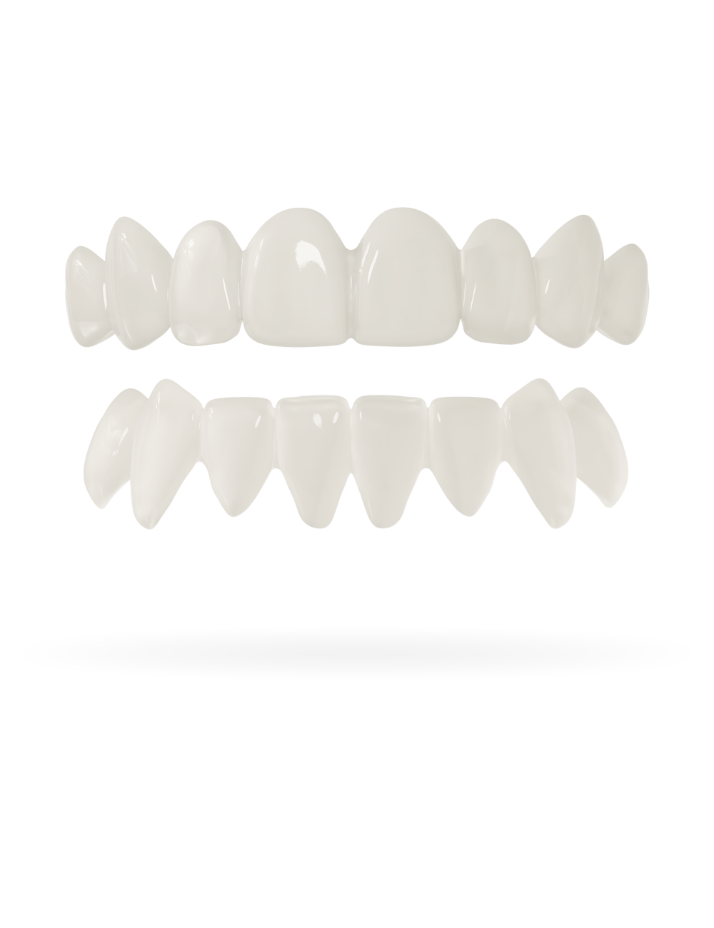 Zahn-Veneer 3.0